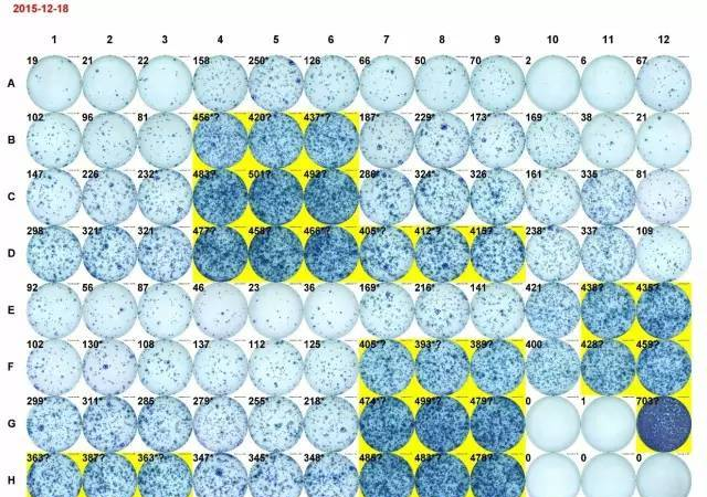 獻給初學者： ELISPOT 操作全攻略