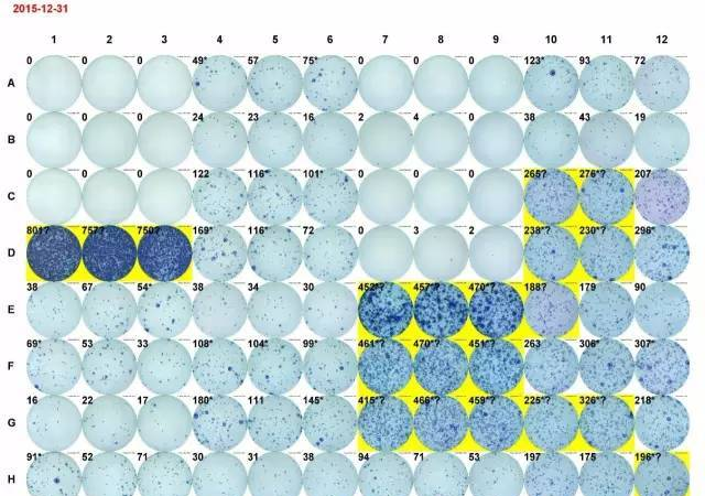 獻給初學者： ELISPOT 操作全攻略