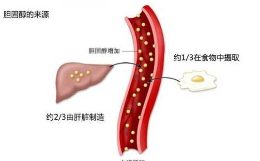 一年一度體檢，膽固醇偏高怎么辦（全攻略）