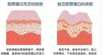 女人怎樣補(bǔ)充膠原蛋白？這三點(diǎn)要記住了否則....