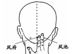 后腦勺痛的原因