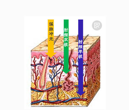 拉皮一次多少錢，拉皮的費(fèi)用，拉皮術(shù)除皺無力吐槽?。?> </div> <div   id=