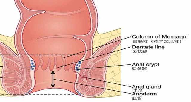 究竟什么是痔瘡，得了痔瘡又該怎么辦呢？