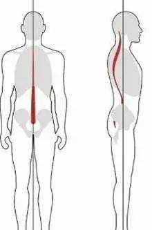 「脊柱側彎」有多恐怖你知道嗎？該如何矯正