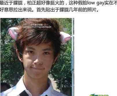 于朦朧整容前后照片 于朦朧是GAY 于朦朧整容前后對比照