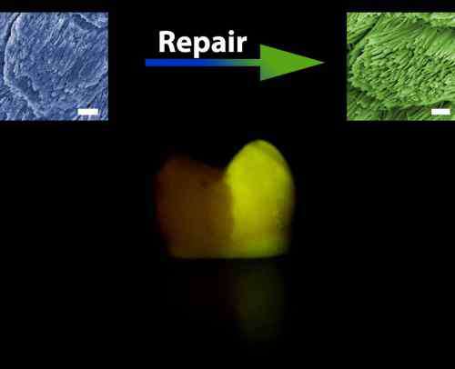 劉昭明 中國(guó)科學(xué)家新發(fā)明，實(shí)現(xiàn)牙釉質(zhì)自我修復(fù)