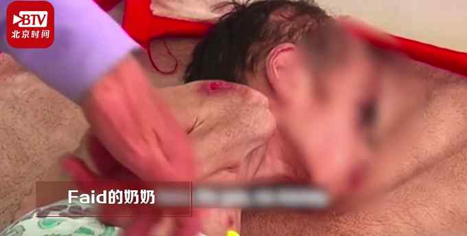 也門一7歲男孩體重僅7公斤 不敢多看一眼！網(wǎng)友哭了