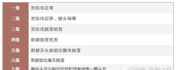 電頭發(fā)掉發(fā)還會(huì)長(zhǎng)嗎 脫發(fā)等級(jí)對(duì)照?qǐng)D，你到幾級(jí)了，看看還有救沒？
