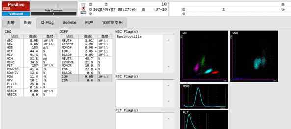 嗜酸性粒細(xì)胞偏高原因 細(xì)思極恐，嗜酸性粒細(xì)胞如此之高，竟然是……