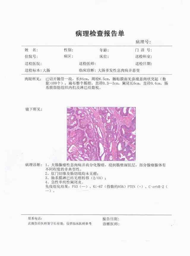 病理檢查 已經(jīng)臨床診斷為癌癥了，為什么還要做病理活檢？是不是過(guò)度檢查