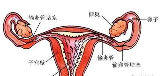 輸卵管造影疼嗎 做子宮輸卵管造影到底疼不疼