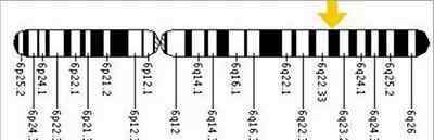 精氨酸酶 精氨酸酶缺乏癥（Arginase deficiency）