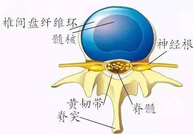 椎間盤突出的保守治療 腰椎間盤突出80%-90%不需要手術(shù)，可以這樣治....