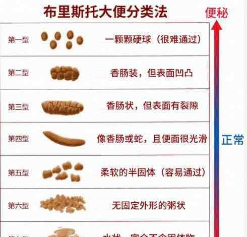 為什么大便不成形 大便不成形一定是“腸癌”嗎？勿慌，醫(yī)師告訴你該怎么辦！