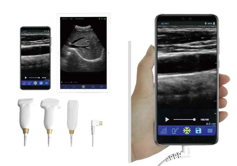 便攜式b超機(jī) 便攜式B超_掌上B超機(jī)的發(fā)展應(yīng)用趨勢