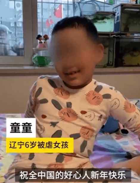 河南頭發(fā)種植 遼寧6歲被虐女童現(xiàn)狀恢復(fù)良好，頭發(fā)種植成功，網(wǎng)友：放心了！