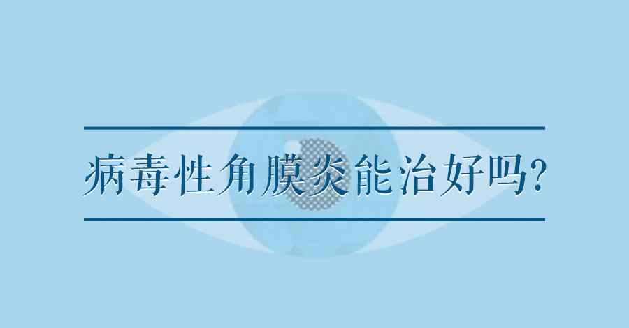 病毒性角膜炎的治療 問醫(yī)生：病毒性角膜炎能治好嗎?