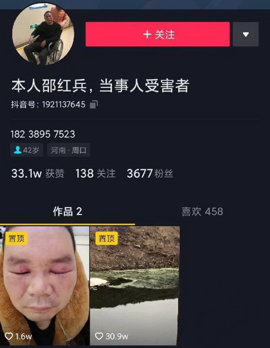 河南男子匿名舉報工廠污染被打傷 涉事腸衣公司被封 官方查泄密“內(nèi)鬼”