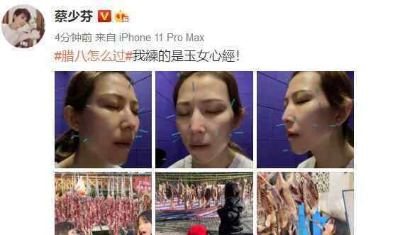 在照片上扎針害人 蔡少芬曬照“練玉女心經(jīng)”，臉上和頭上扎針有點嚇人，而張晉“扎心了”