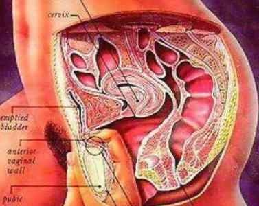 女人g點(diǎn)在什么位置圖解 摳弄g點(diǎn)速度如何掌握?