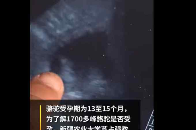 駱駝交配 新疆1700多頭駱駝集體做B超，快速判斷母駱駝是否配種成功