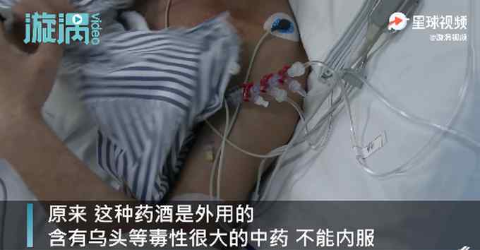 男子春節(jié)聚會被藥酒送進(jìn)ICU 醫(yī)生一看才知此藥酒是外用的！