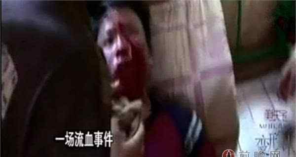 變形計李錦鑒 變形計李錦鑒流血事件真相曝光 回訪變陽光少年考上音樂學(xué)院