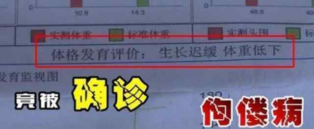 三鹿奶粉事件 “大頭娃娃”再現(xiàn)，堪比12年前的三鹿奶粉事件，網(wǎng)友：實(shí)在無(wú)法原諒