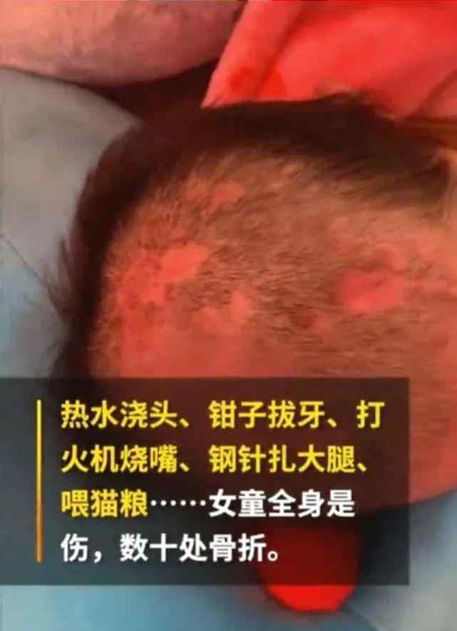 虐點伢 6歲女孩被親媽虐待，手段殘忍氣炸全網：離婚后，她為何淪為人渣？！