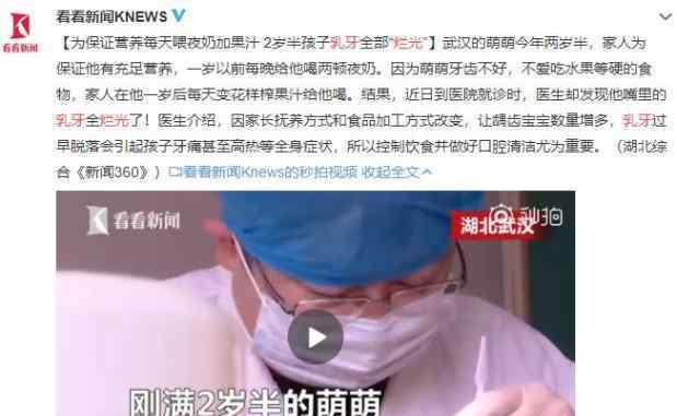 2歲寶寶牙腐蝕怎么補救 2歲半寶寶乳牙全爛光，就是這件事沒做好