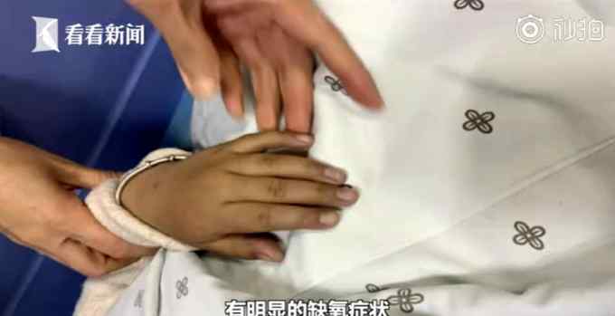 5歲女孩吃自家腌制的泡菜中毒 嘴唇指甲都變紫了！醫(yī)生這樣說