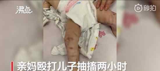 女子打傷1歲兒子已立案 事件具體什么情況