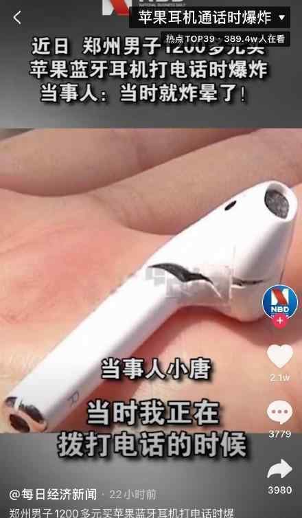 蘋果AirPods爆炸 做什么的時候爆炸了傷勢嚴重嗎