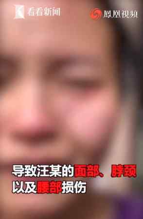 警方通報外籍確診患者打傷護(hù)士 警方如何通報的