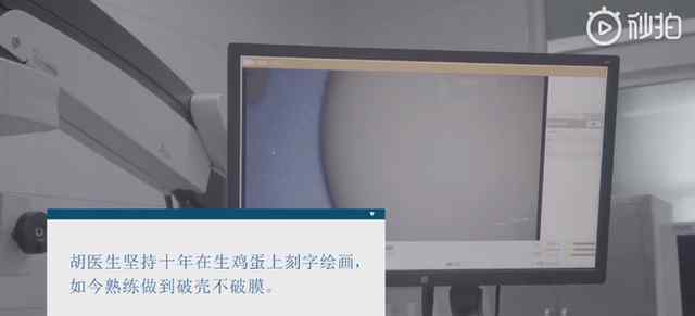 醫(yī)生練就在生雞蛋殼上刻字絕活 網(wǎng)友：手術(shù)臺上一分鐘，臺下十年功