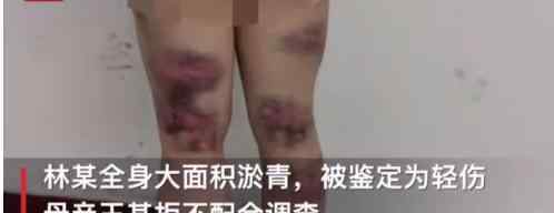 母親暴打30歲女兒被刑拘 家長(zhǎng)打孩子犯法嗎