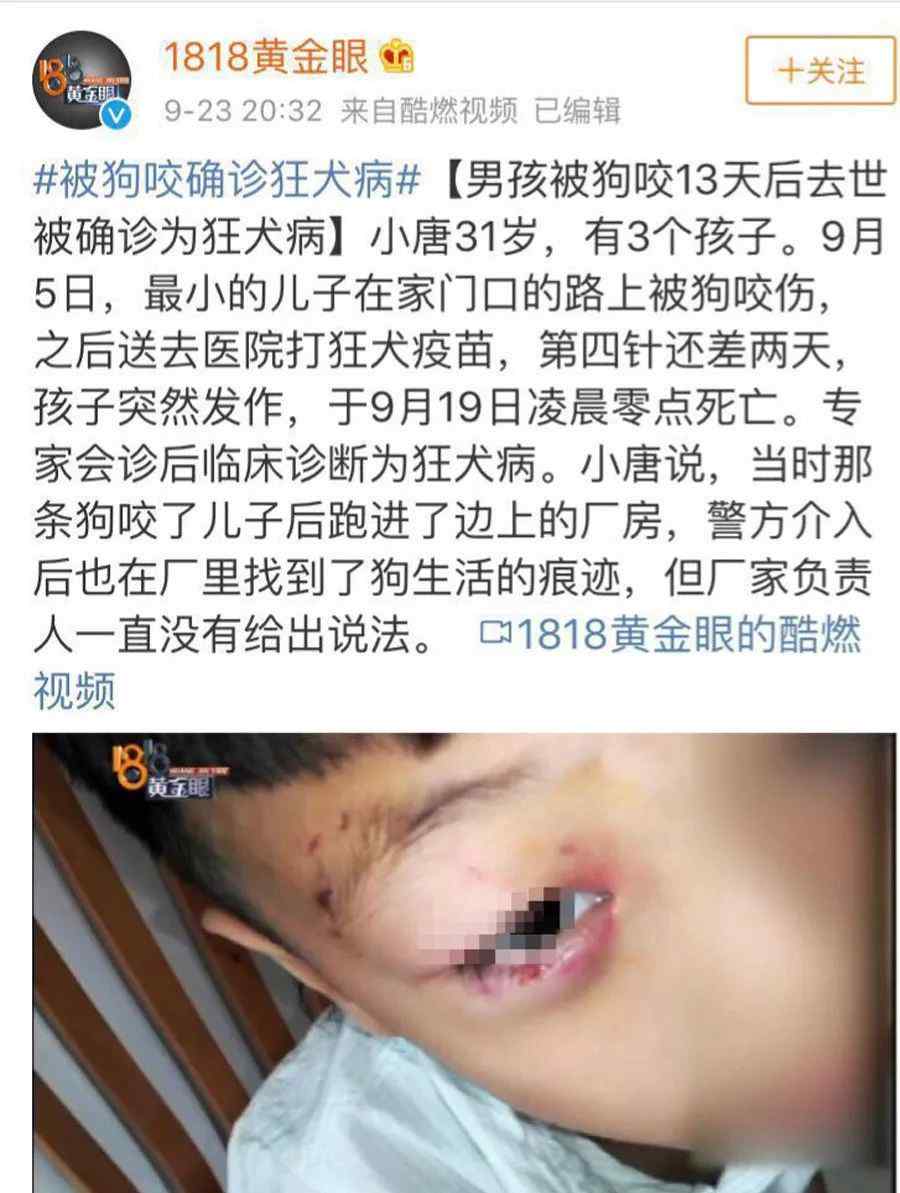 rabies 被狗咬 13 天后去世，面對狂犬病我們該怎么辦