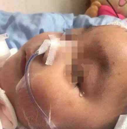 女童遭生母虐待數(shù)次腦死亡：如有來(lái)世 愿你能被溫柔相待