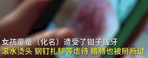 6歲被虐女童姥姥發(fā)聲 具體回應(yīng)了什么內(nèi)容