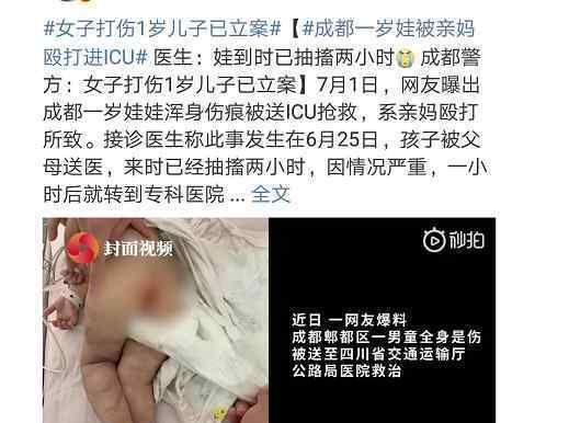 1歲嬰兒因哭鬧不止被母親毆打，全身多處瘀傷住進ICU