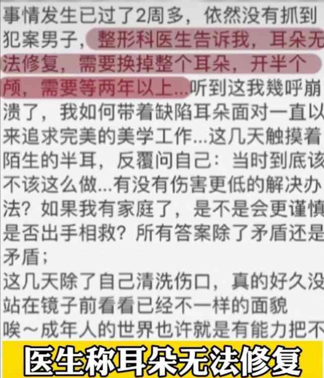 阻止性侵被咬耳男子稱不后悔 男子被咬耳朵詳情始末