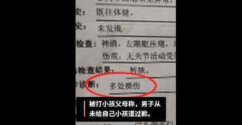 男子遭惡作劇電梯內(nèi)暴打小孩 小孩被打視頻泄露畫面慘不忍睹