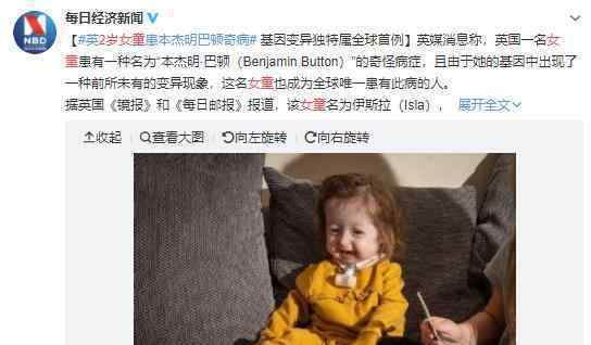 2歲女童面容衰老是怎么回事?2歲女童患怪病變衰老?