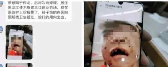 黑龍江虐童案生父繼母被批捕 究竟發(fā)生了什么