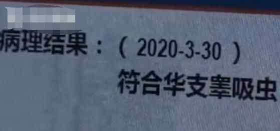 女子體內(nèi)取出“活蟲”還自由蠕動 只因愛吃這道菜真相簡直令人崩潰