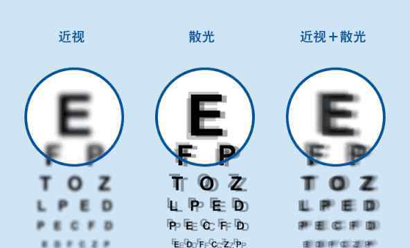 眼睛散光是什么癥狀 散光到底是什么？你真的以為自己散光嗎？