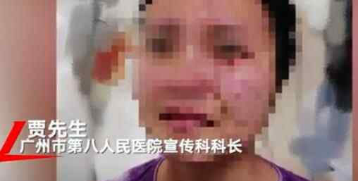 女護(hù)士被患新冠老外暴打撕咬滿臉傷痕 對(duì)著鏡頭流淚令人心碎究竟是怎么回事？