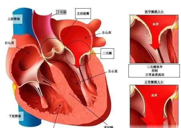 心臟增大能恢復(fù)正常嗎 心臟瓣膜和心臟功能都正常，但是心房增大了，這意味著什么？