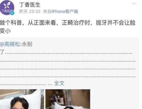 高曉松丁香醫(yī)生上熱搜 原因是這樣實在太扎心