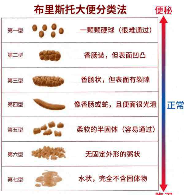 大便不成形是怎么回事 大便不成形一定是腸癌嗎？別慌，醫(yī)生告訴你怎么辦！